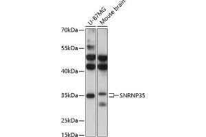 Western blot analysis of extracts of various cell lines, using SNRNP35 antibody (ABIN6132757, ABIN6148206, ABIN6148207 and ABIN6217126) at 1:3000 dilution. (SNRNP35 抗体  (AA 1-150))