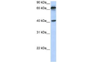 WB Suggested Anti-MICA Antibody Titration:  0. (MICA 抗体  (N-Term))