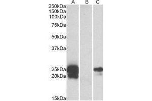 Western Blotting (WB) image for anti-WAP Four-Disulfide Core Domain 2 (WFDC2) (Internal Region) antibody (ABIN2464648) (WFDC2 抗体  (Internal Region))