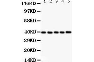 Anti- CXCR6 antibody,  Western blotting All lanes: Anti CXCR6 () at 0.