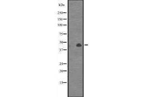 Western blot analysis of CANT1 expression in Jurkat cell line lysates,The lane on the left is treated with the antigen-specific peptide. (CANT1 抗体  (Internal Region))