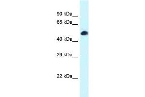 Western Blotting (WB) image for anti-Transcription Factor 7-Like 2 (T-Cell Specific, HMG-Box) (TCF7L2) (N-Term) antibody (ABIN2778365) (TCF7L2 抗体  (N-Term))