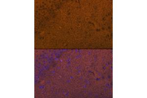Immunofluorescence (IF) image for anti-Glutamate Receptor 1 (GLUR1) (AA 19-300) antibody (ABIN3015589)