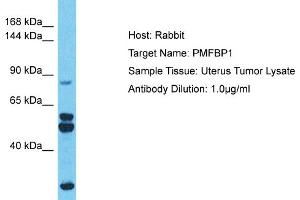 Host: Rabbit Target Name: PMFBP1 Sample Type: Uterus Tumor lysates Antibody Dilution: 1. (PMFBP1 抗体  (Middle Region))