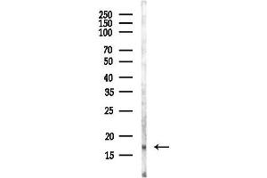 Western blot analysis of lysates from Rat lung, using Tri-Methyl-Histone H3 (Lys27)/H3K27me3 Antibody at 1/1000 dilution.
