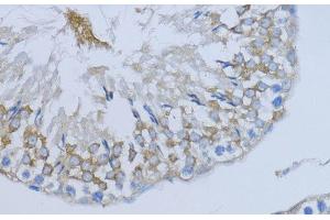 Immunohistochemistry of paraffin-embedded Rat testis using NRG4 Polyclonal Antibody at dilution of 1:200 (40x lens). (Neuregulin 4 抗体)