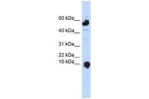 C1ORF151 antibody used at 1 ug/ml to detect target protein. (C1orf151 抗体  (Middle Region))
