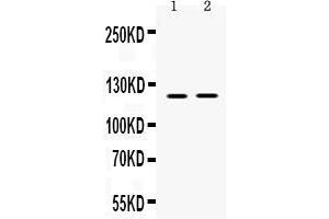 Western blot analysis of Ceruloplasmin expression in rat skeletal muscle extract ( Lane 1), and NIH3T3 whole cell lysates ( Lane 2). (Ceruloplasmin 抗体  (AA 20-258))