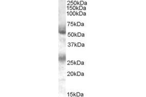 Western Blotting (WB) image for anti-Annexin A13 (ANXA13) (C-Term) antibody (ABIN2775608) (Annexin A13 抗体  (C-Term))