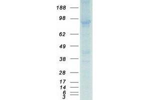 Western Blotting (WB) image for phosphodiesterase 5A, cGMP-Specific (PDE5A) (Transcript Variant 2) protein (Myc-DYKDDDDK Tag) (ABIN2728518)