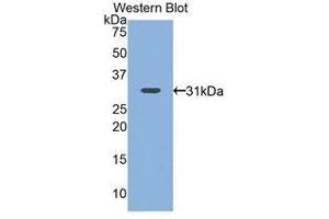 Western Blotting (WB) image for anti-Nicotinamide N-Methyltransferase (NNMT) (AA 1-258) antibody (ABIN1860015) (NNMT 抗体  (AA 1-258))
