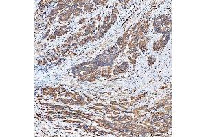IHC analysis of SLC40A1 using anti-SLC40A1 antibody (ABIN7599484).