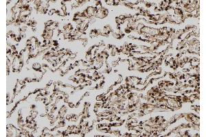 ABIN6272508 at 1/100 staining Human lung tissue by IHC-P. (MAGEA8 抗体  (C-Term))