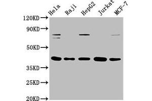 Western Blot Positive WB detected in: Hela whole cell lysate, Raji whole cell lysate, HepG2 whole cell lysate, Jurkat whole cell lysate, MCF-7 whole cell lysate All lanes: FEN1 antibody at 0. (Recombinant FEN1 抗体)