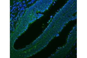 IF analysis of Citrin/SLC25A13 using anti-Citrin/SLC25A13 antibody (ABIN7599512). (slc25a13 抗体  (AA 1-643))