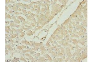 Immunohistochemistry of paraffin-embedded human heart tissue using ABIN7167204 at dilution of 1:100 (RAC3 抗体  (AA 1-192))