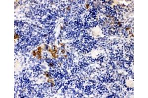 IHC-P: Leupaxin antibody testing of rat spleen tissue (Leupaxin 抗体  (N-Term))