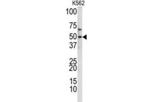 Western Blotting (WB) image for anti-Kruppel-Like Factor 11 (KLF11) antibody (ABIN3002716) (KLF11 抗体)