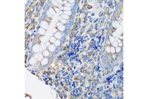 Immunohistochemistry of paraffin-embedded human appendix using eEF2 Rabbit mAb (ABIN7267025) at dilution of 1:100 (40x lens).