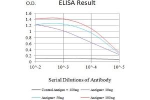 Black line: Control Antigen (100 ng),Purple line: Antigen (10 ng), Blue line: Antigen (50 ng), Red line:Antigen (100 ng) (SARS-Cov2-NP2 (AA 120-300) 抗体)