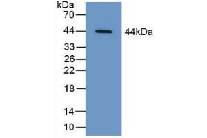 Detection of Recombinant CAP3, Human using Polyclonal Antibody to Cytoplasmic Antiproteinase 3 (CAP3) (SERPINB9 抗体  (AA 1-376))