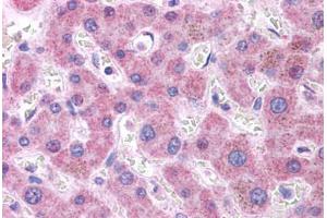 Human Liver: Formalin-Fixed, Paraffin-Embedded (FFPE) (APOB 抗体  (AA 4031-4080))