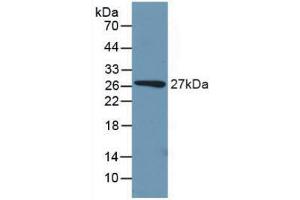 Western blot analysis of recombinant Mouse PCK1. (PCK1 抗体  (AA 312-563))