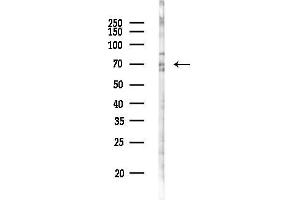 Western blot analysis of lysates from K562 cells(UV 30 min treatment), using GRHL3 Antibody at 1/1000 dilution.