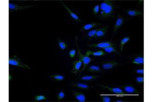 Immunofluorescence of purified MaxPab antibody to ZFYVE16 on HeLa cell. (ZFYVE16 抗体  (AA 1-809))