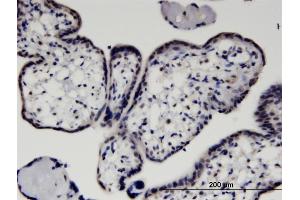 Immunoperoxidase of monoclonal antibody to HEXIM1 on formalin-fixed paraffin-embedded human placenta. (HEXIM1 抗体  (AA 1-359))
