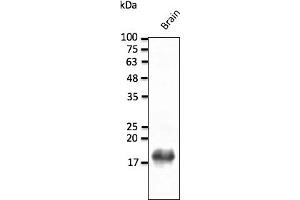 Western Blotting (WB) image for anti-Synuclein, beta (SNCB) (C-Term) antibody (ABIN7273028) (beta Synuclein 抗体  (C-Term))