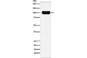 Western Blotting (WB) image for anti-Amyloid beta (A4) Precursor Protein-Binding, Family B, Member 1 (Fe65) (APBB1) antibody (ABIN7606802)