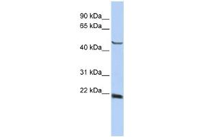 WB Suggested Anti-SSX4 Antibody Titration:  0. (SSX4 抗体  (Middle Region))