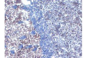 PICK1 Immunohistochemistry. (PICK1 抗体)