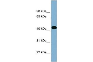WB Suggested Anti-ITPK1 Antibody Titration: 0. (ITPK1 抗体  (Middle Region))