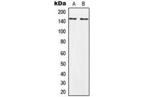 Western blot analysis of PALLD expression in HeLa (A), PC3 (B) whole cell lysates. (PALLD 抗体  (Center))