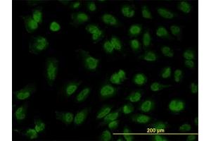 Image no. 3 for anti-Forkhead Box R2 (FOXR2) (AA 1-312) antibody (ABIN599326) (FOXR2 抗体  (AA 1-312))