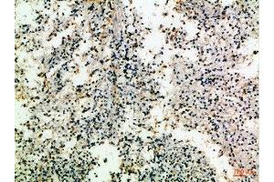 Immunohistochemical analysis of paraffin-embedded Human-spleen, antibody was diluted at 1:100 (CD8 抗体  (AA 100-160))
