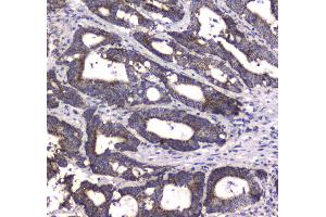 IHC analysis of MRE11 using anti-MRE11 antibody . (Mre11 抗体  (AA 2-239))