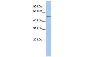 WB Suggested Anti-EIF5 Antibody Titration: 0. (EIF5 抗体  (N-Term))