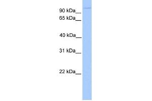 WB Suggested Anti-NUP98 Antibody Titration: 0. (NUP98 抗体  (N-Term))