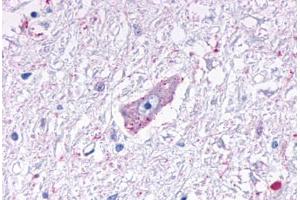Anti-MRGPRD antibody  ABIN1049070 IHC staining of human brain, medulla. (MRGPRD 抗体  (Cytoplasmic Domain))