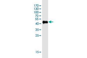 Western Blot detection against Immunogen (43. (KIAA1143 抗体  (AA 1-154))