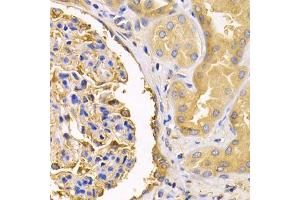 Immunohistochemistry of paraffin-embedded human kidney using USO1 antibody (ABIN5971479) at dilution of 1/200 (40x lens). (USO1 抗体)