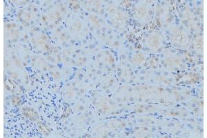 ABIN6279361 at 1/100 staining Mouse kidney tissue by IHC-P. (POLG 抗体  (Internal Region))