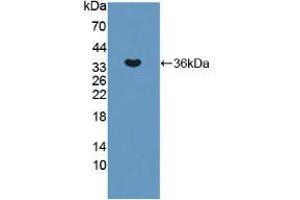 Western blot analysis of recombinant Human ERN1. (ERN1 抗体  (AA 571-832))