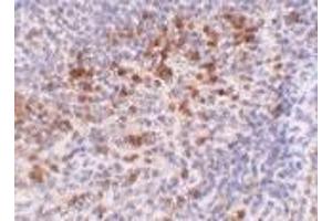 Immunohistochemistry of Catheli-cidin in human spleen tissue with Cathelicidin antibody at 5 μg/ml. (Cathelicidin 抗体  (C-Term))