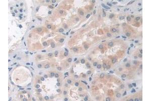 Detection of PAR4 in Human Kidney Tissue using Polyclonal Antibody to Protease Activated Receptor 4 (PAR4)