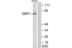 Western Blotting (WB) image for anti-Guanylate Binding Protein 1, Interferon-Inducible (GBP1) (Internal Region) antibody (ABIN1850388) (GBP1 抗体  (Internal Region))