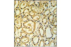 Immunohistochemistry analysis in Formalin Fixed, Paraffin Embedded Human lung tissue using RT25 antibody (C-term) followed by peroxidase conjugation of the secondary antibody and DAB staining. (MRPS25 抗体  (C-Term))